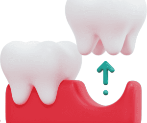 Tooth Extractions in Cincinnati