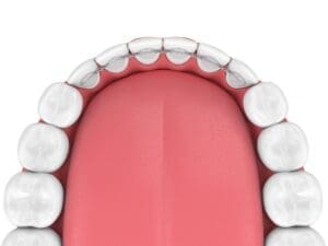 Broken Dental Appliance Treatment