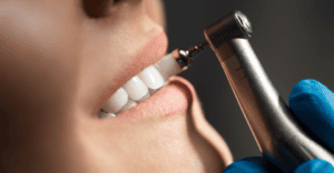 Cincinnati Dental Cleanings